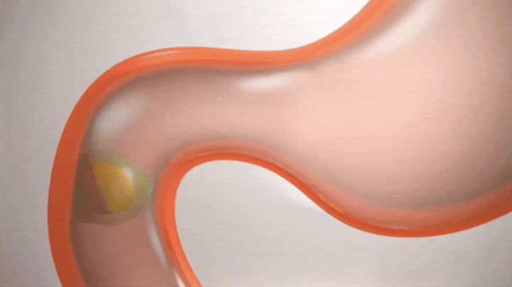 씨코랩 씨코핏 후기, 효과, 가격, 씨코다이어트