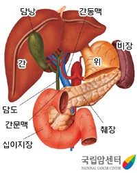 담도암