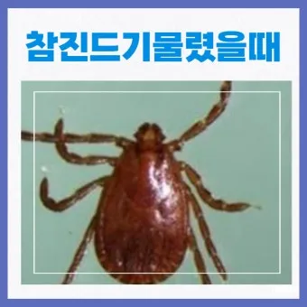 진드기 물린자국 대처법 참진드기 빨간 진드기 증상 확인_18