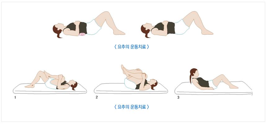 요통-완화를-위한-운동법