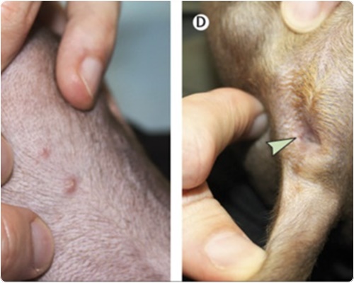 엠폭스 증상 및 원인