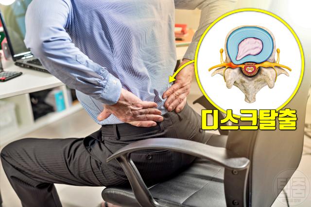 좌골신경통 예방 습관 의자 앉은자세