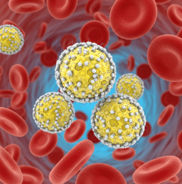 LDL 콜레스테롤 낮추는 방법2