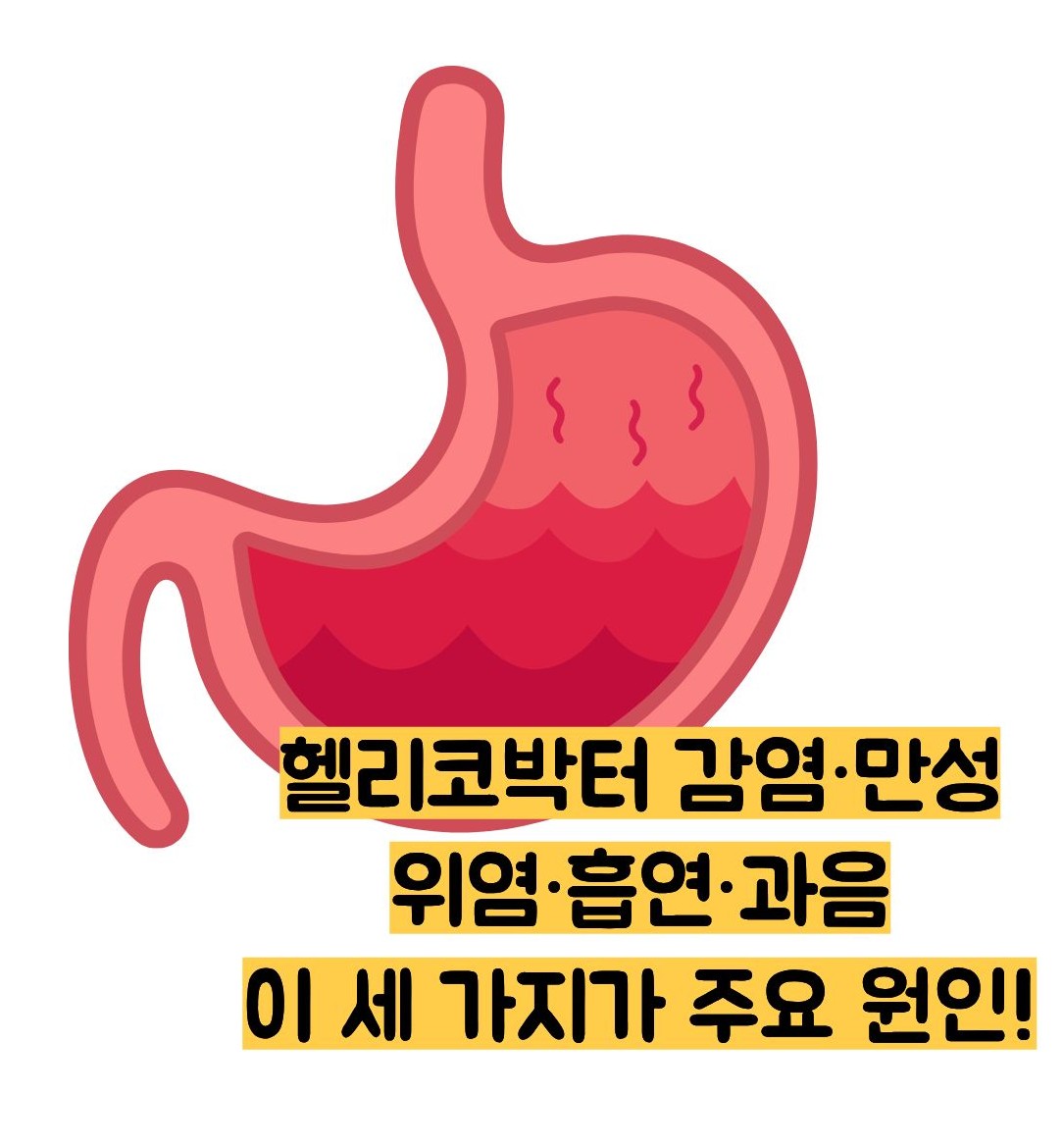 장상피화생 뜻