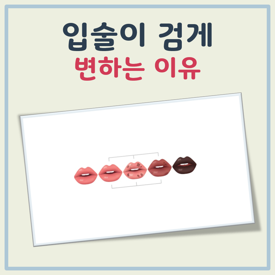 입술이 검게 변하는 이유 대표 이미지