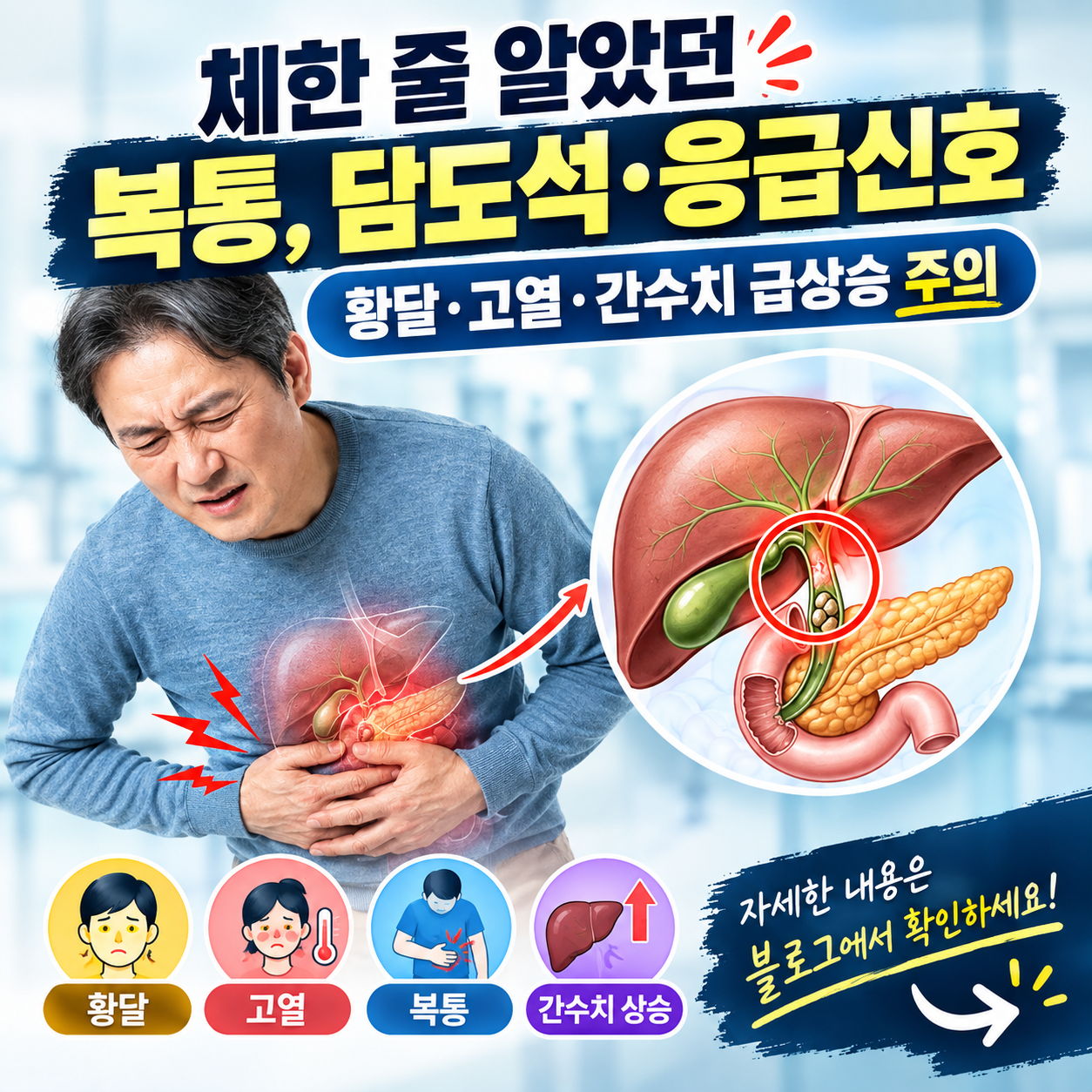 고령자 급성 담관염
