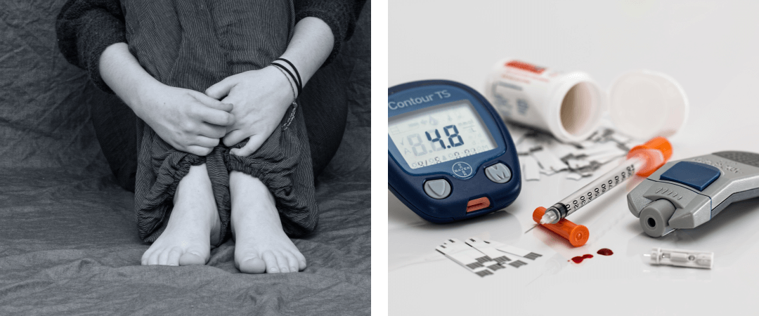 다리를 모으고 종아리를 감싸쥔 흑백사진(우울증)&#44; 당뇨 관련 기구 사진