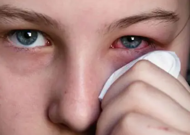 눈꼽이 잘 끼는 이유, 유난히 많이 생기는 원인