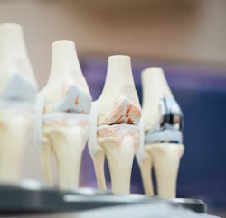 콘드로이친 효능 복용법 시간 부작용