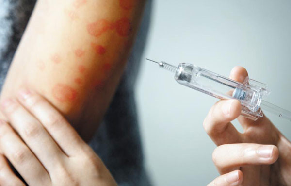 대상포진 예방접종