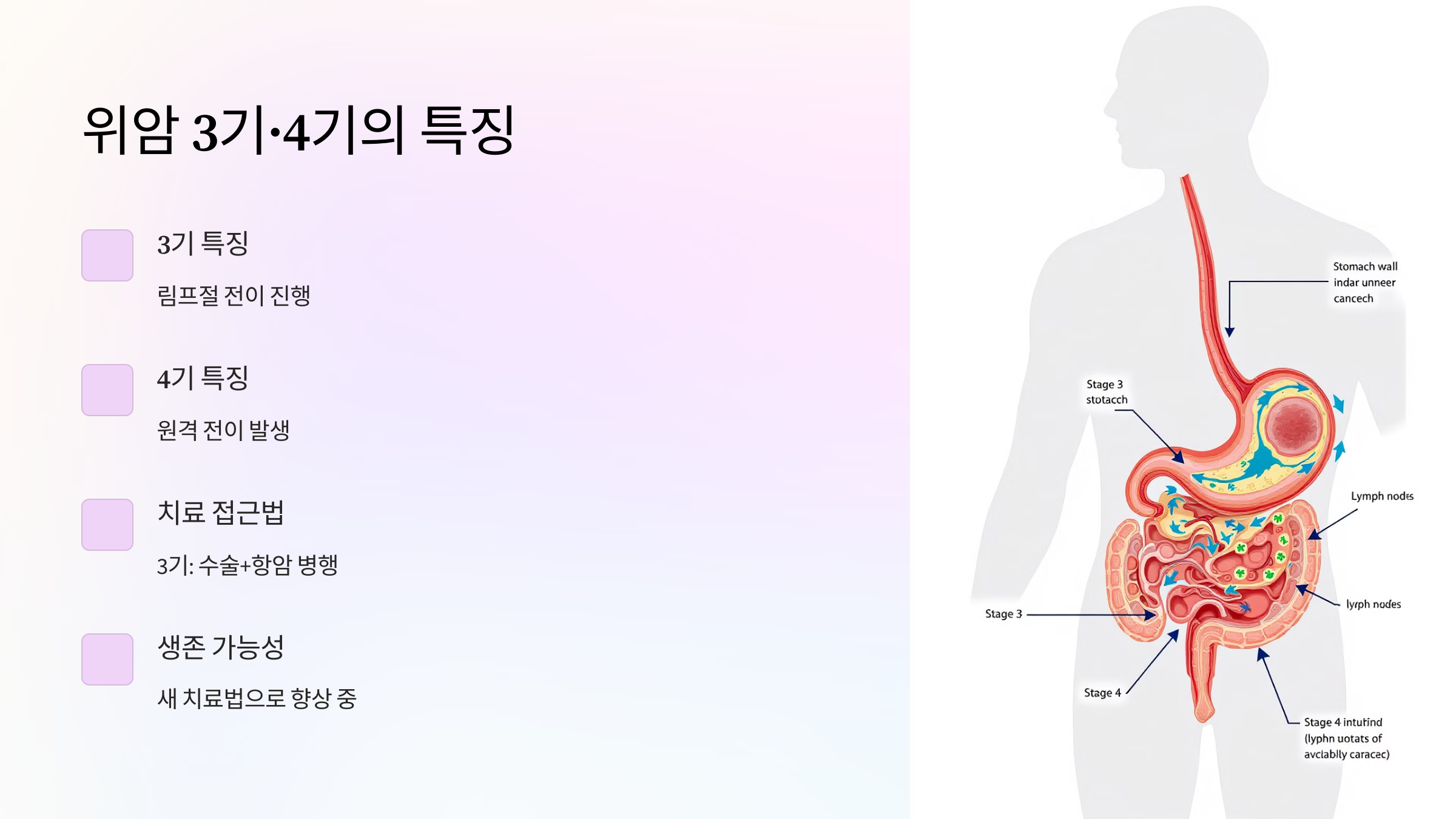 위암 3기&middot;4기의 특징