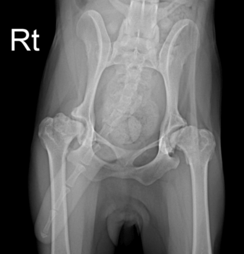 고관절 이형성증