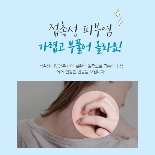 접촉성 피부염