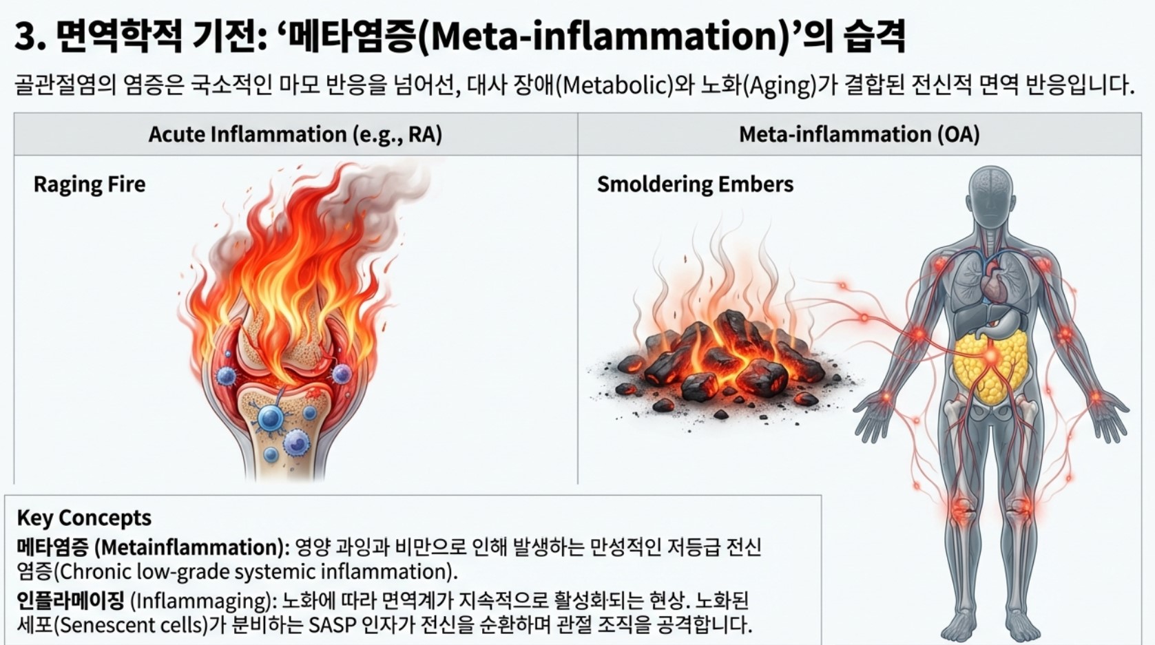 염증반응과 관절염
