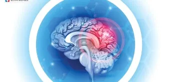 뇌진탕 초기 증상 후유증 으로_11