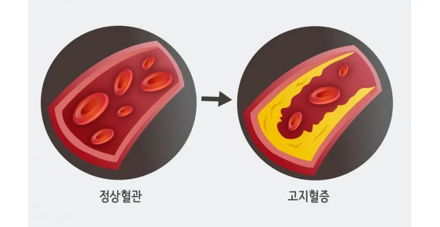 종합소득세 환급금 조회