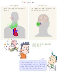 이명증 치료 방법과 효과