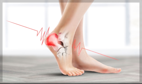 발목 접질림의 주요 증상
