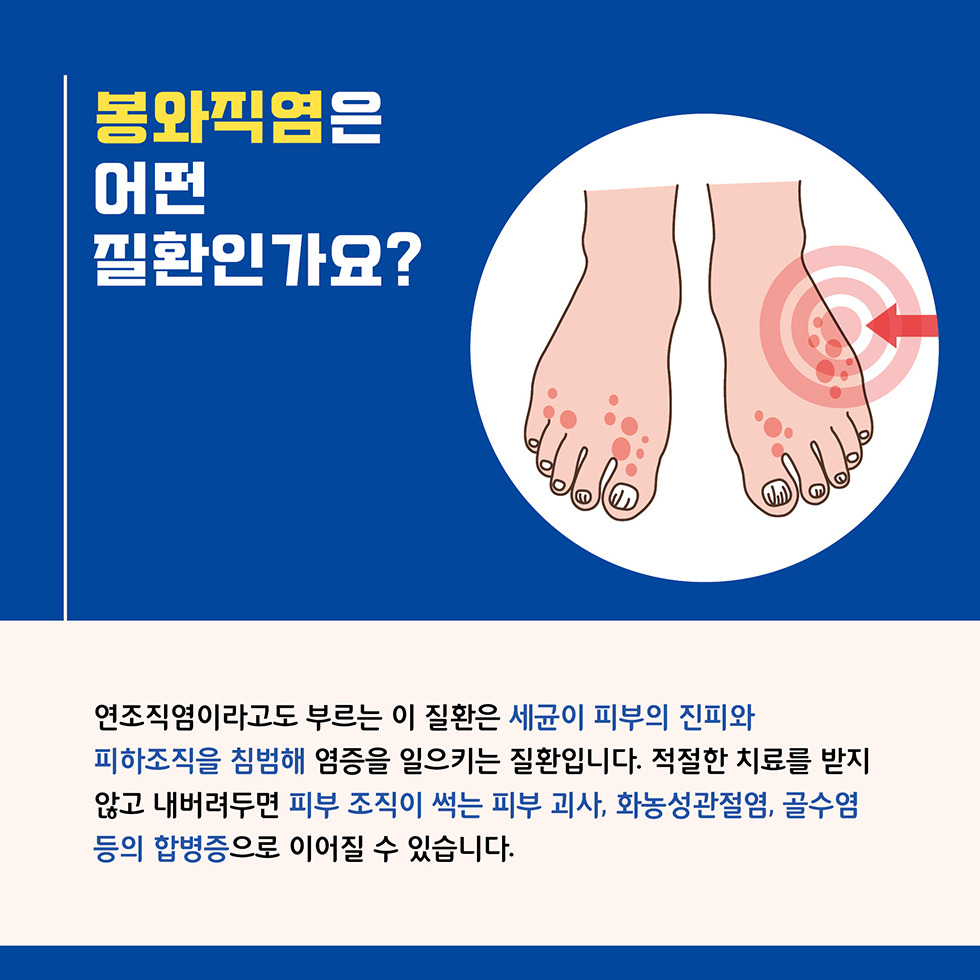 봉화직염이란 어덩 질환인가요?