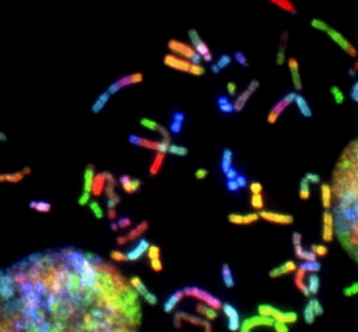 섬유근육통 초기증상 원인 치료법