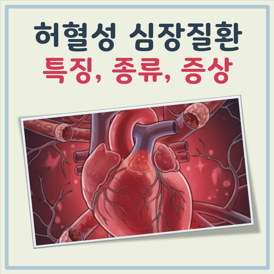 허혈성 심장질환 대표 이미지