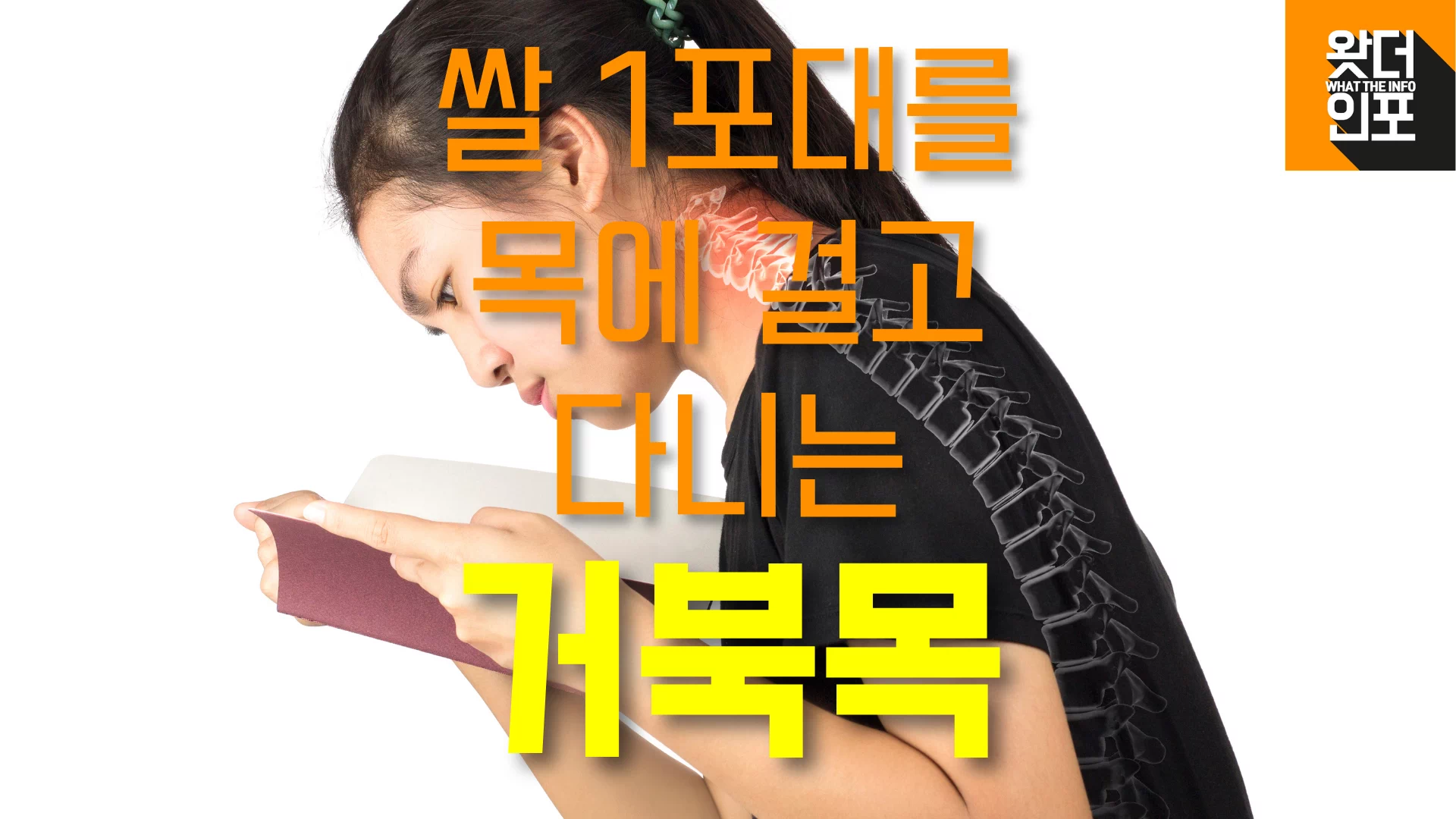 거묵목 증후군(터스트넥 증후군)에 대해