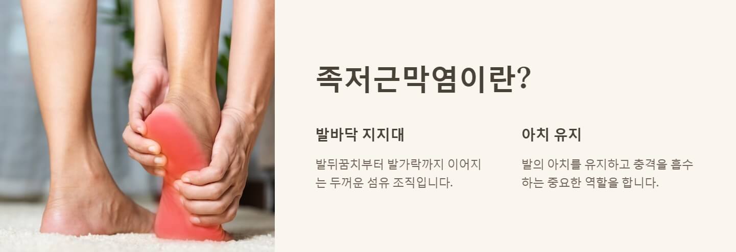 족저근막염 증상 치료법