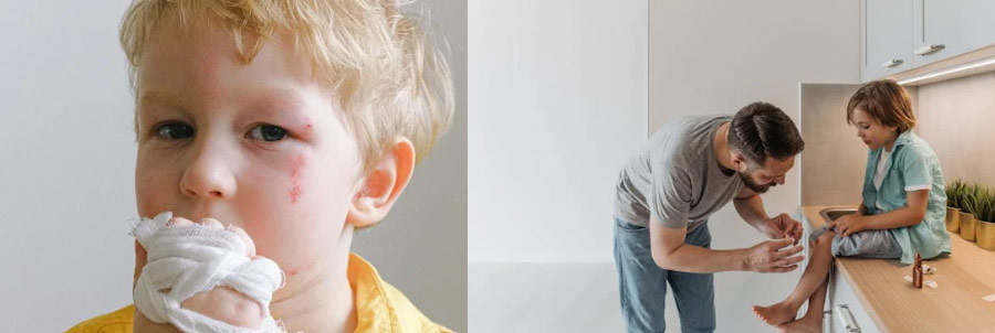 아이들 상처 치료 및 화상흉터제거