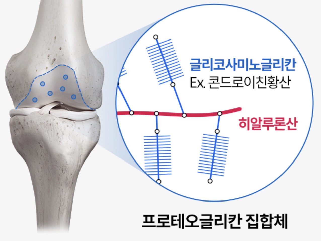 프로테오글리칸