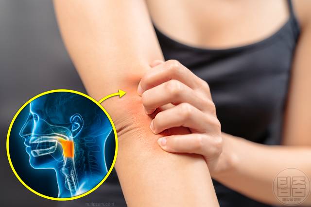 콧물 목 뒤로 넘어가요 후비루 원인 건조한 피부