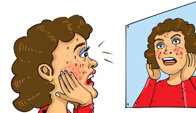 부위별 여드름 원인 및 관리법