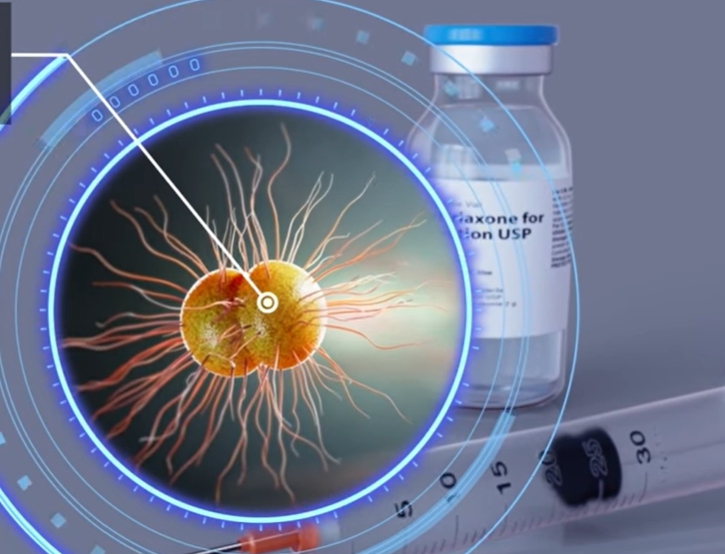 클라미디아 감염 경로