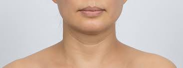 목주름 없애는 비결