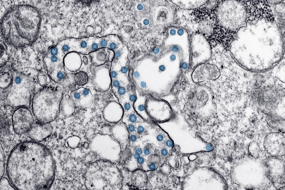 Virus