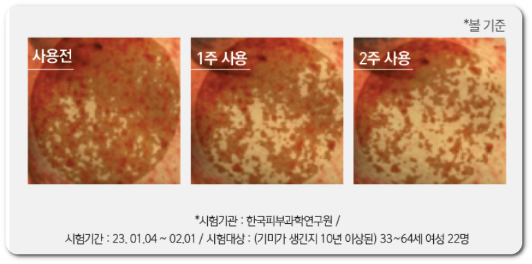 도미나스 크림 4x 효과