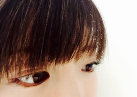 실룩실룩 눈이 경련