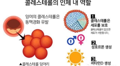 콜레스테롤 이미지