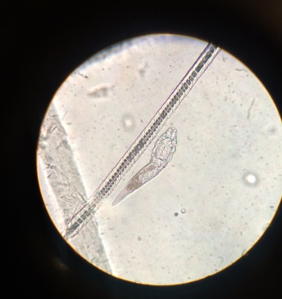 주사피부염 치료를 위한 최신 치료법: 모낭충과 수란트라, 그리고 IPL과 레이저 치료 비교