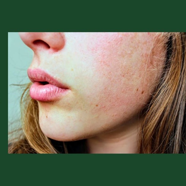 바세린 효능&amp;#44; 활용법