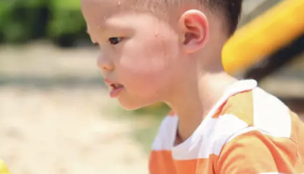 수족구 증상 36