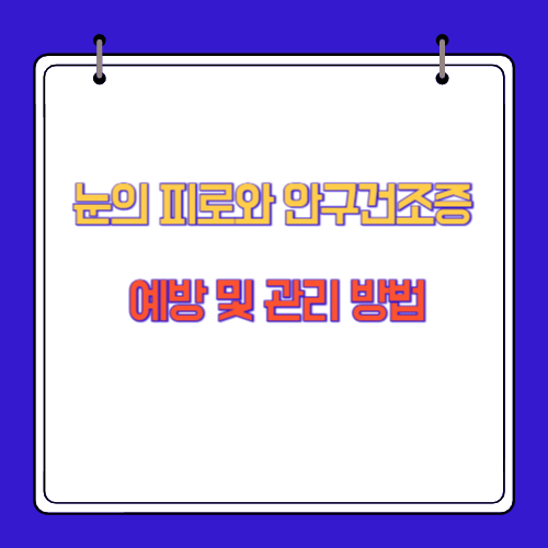 눈의 피로와 안구건조증 예방 및 관리 방법