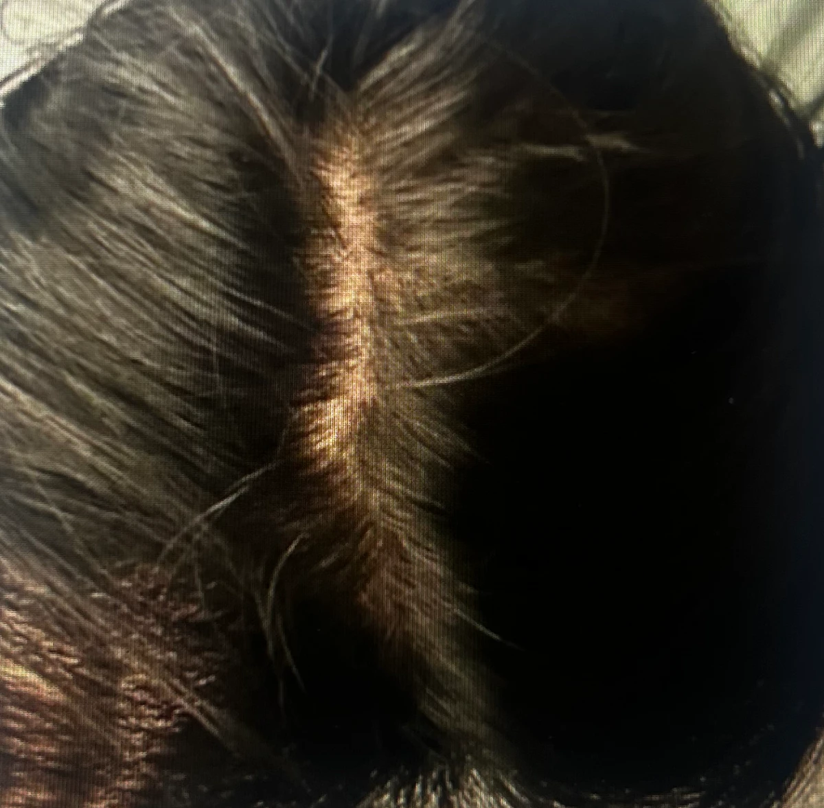 오프온-단백질-탈모-샴푸-사용-전-두피-상태