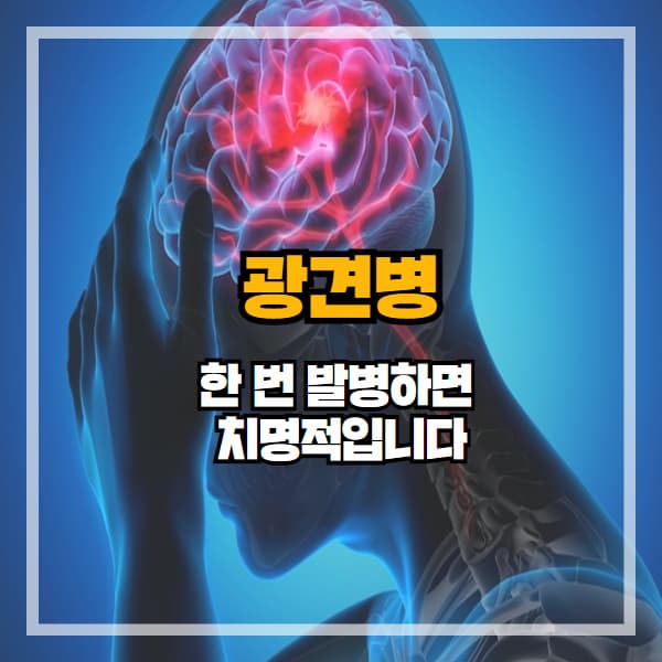 광견병, 한 번 발병하면 치명적입니다. 물렸다면 지금 읽어야 합니다