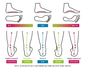 내전화 외전화 차이와 발 보행 유형별 신발 선택법 정리_3