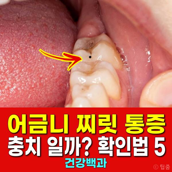 충치 증상 어금닛 찌릿한 통증