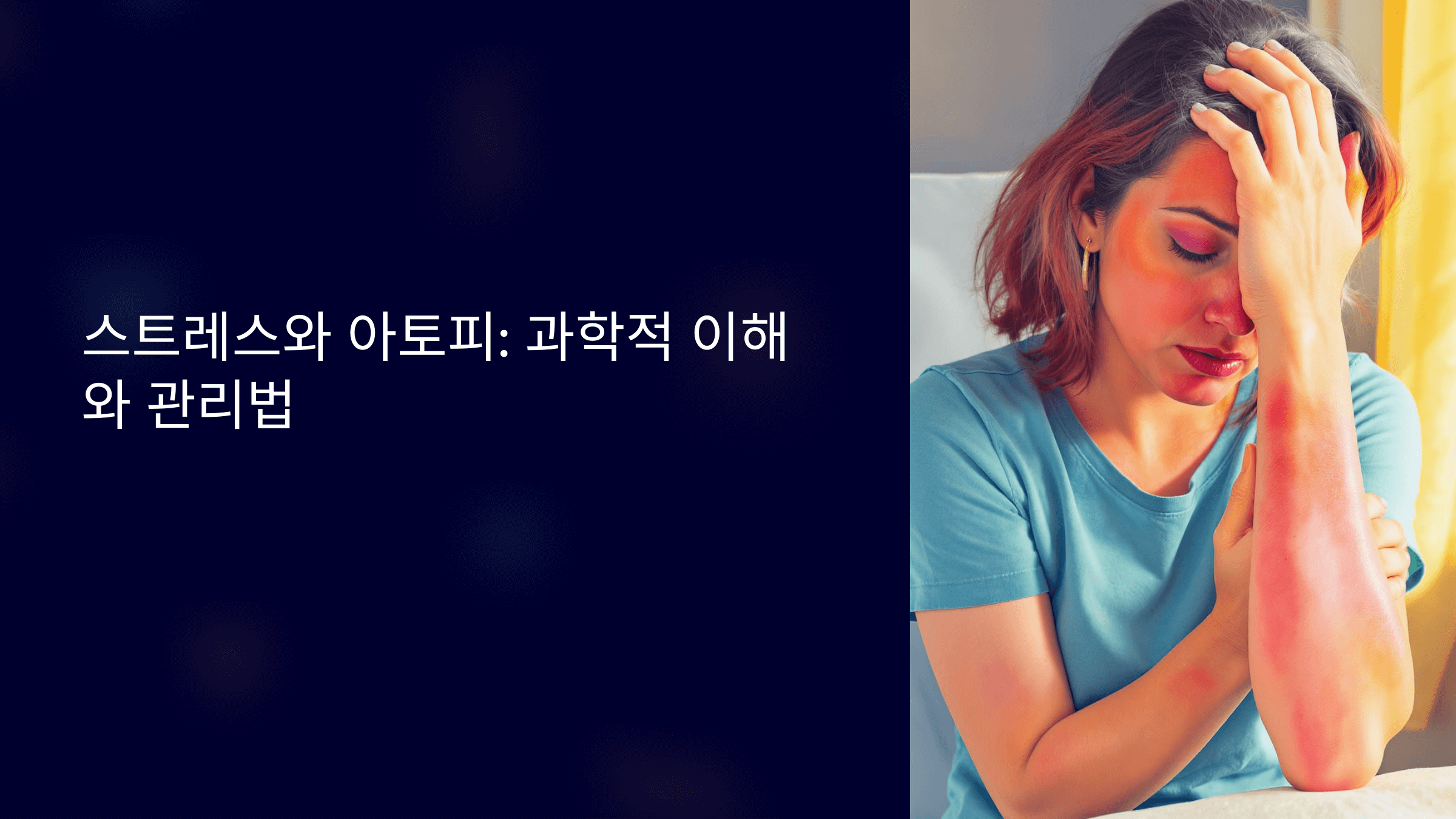 스트레스와 아토피