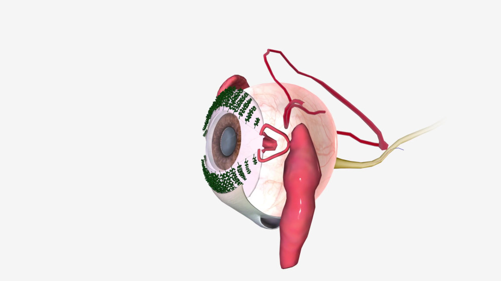 백내장 수술비용