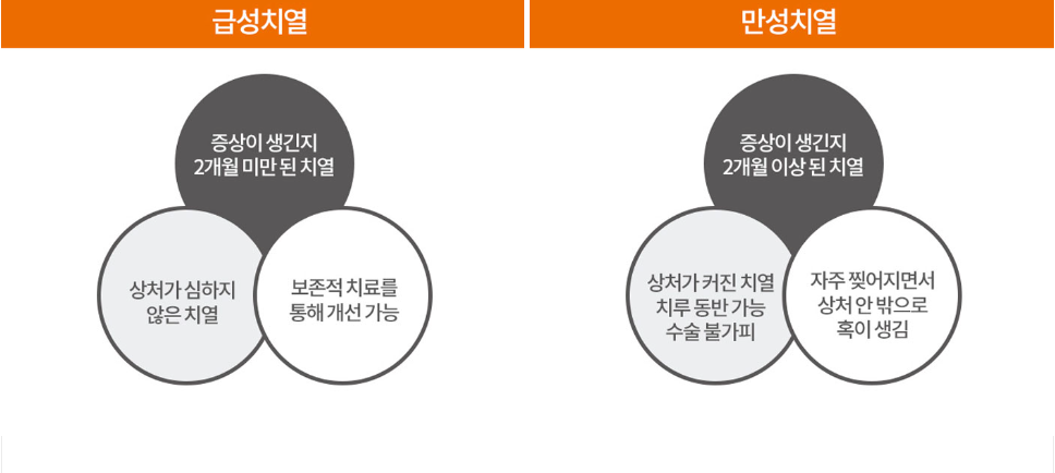 급성치열과 만성치열 정리
