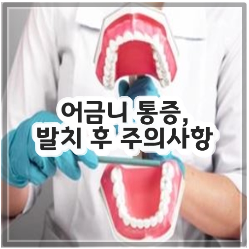 어금니 통증, 발치 후 주의사항