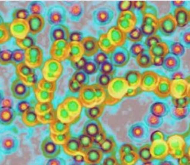 일본-감염병-STSS